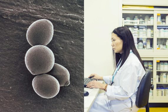 世界で初めてビール酵母の全ゲノム解読に成功